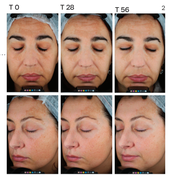 SKIN D-PIGMENT [AHA10 OVERNIGHT]