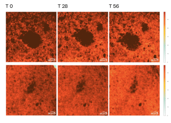 SKIN D-PIGMENT [SERUM ATX B3]