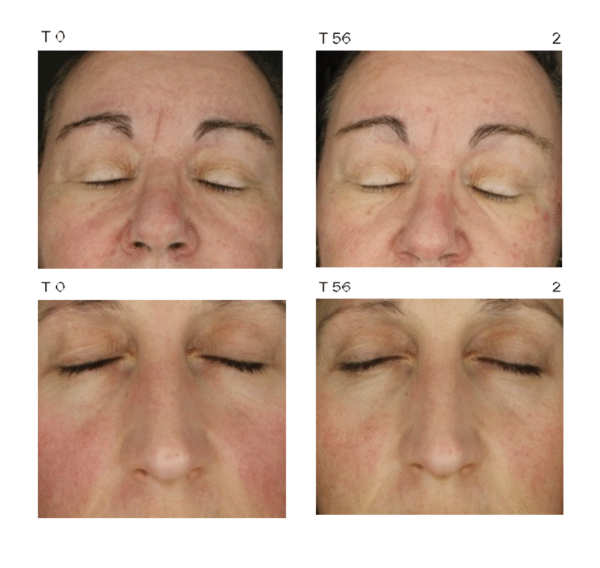 Eternalist AGE Serum