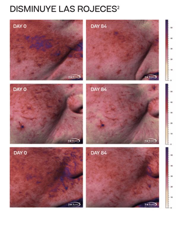 ETERNALIST A.G.E. [RETINOL]